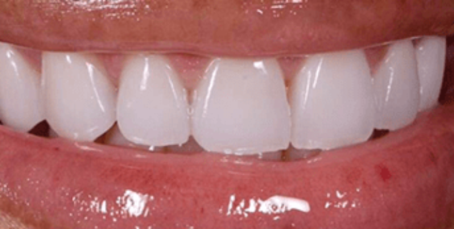 After - Sutton Aesthetic