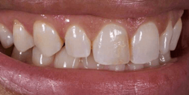 Before - Sutton Aesthetic