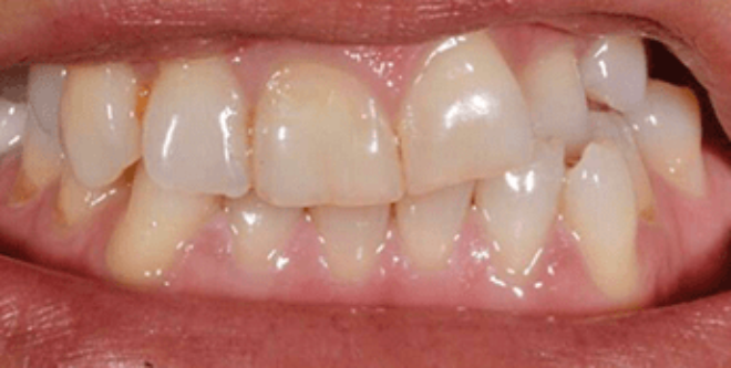 Before - Sutton Aesthetic