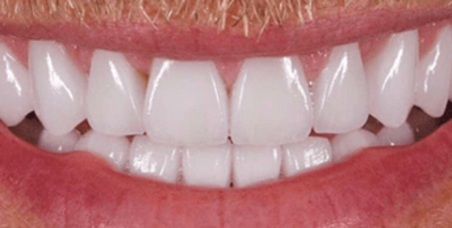 After - Sutton Aesthetic