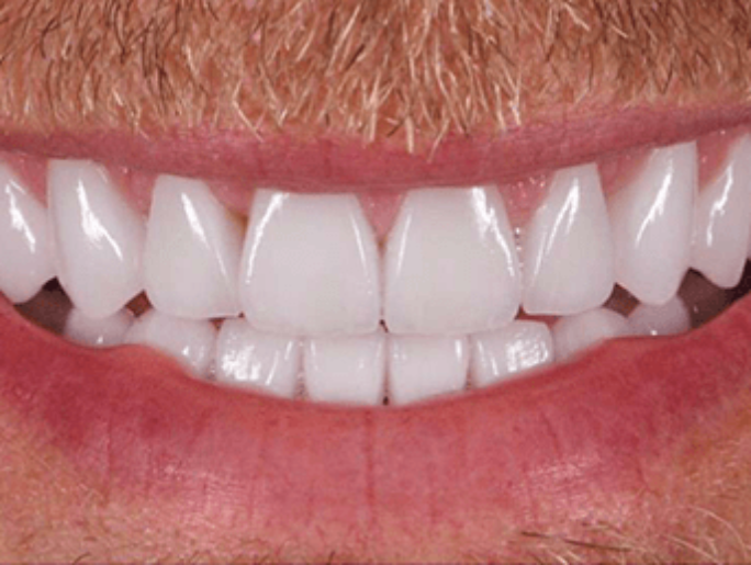 After Sutton Aesthetic Dentistry