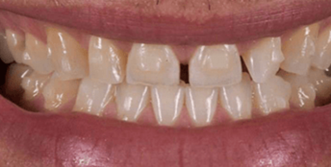 Before - Sutton Aesthetic