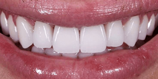 After - Sutton Aesthetic