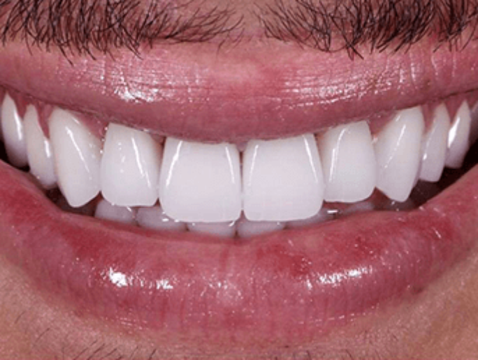 After Sutton Aesthetic Dentistry