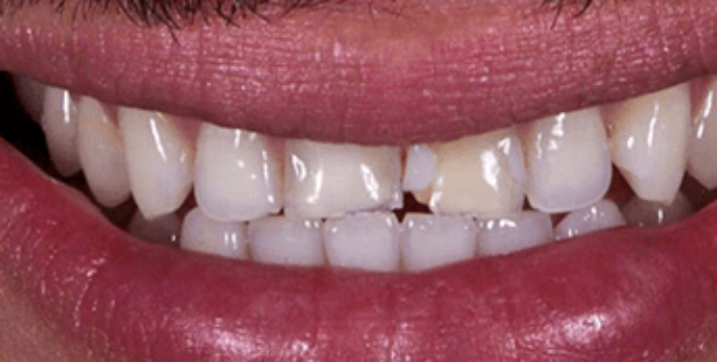 Before - Sutton Aesthetic