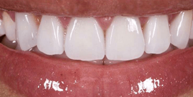 After - Sutton Aesthetic