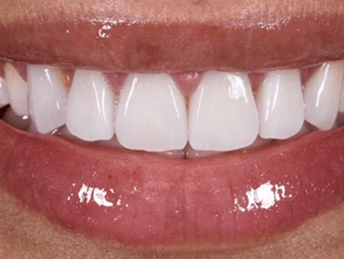 After Sutton Aesthetic Dentistry