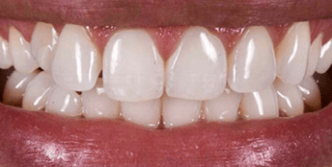 Before - Sutton Aesthetic