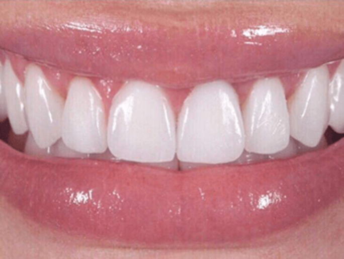 After Sutton Aesthetic Dentistry