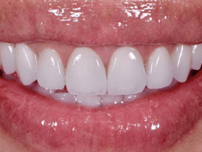 After Sutton Aesthetic Dentistry