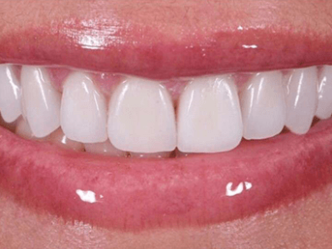 After Sutton Aesthetic Dentistry