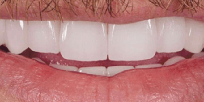 After - Sutton Aesthetic