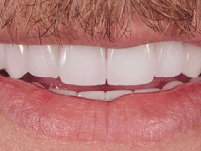 After Sutton Aesthetic Dentistry