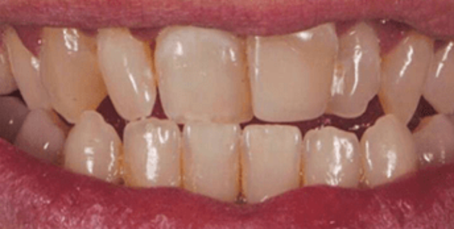 Before - Sutton Aesthetic