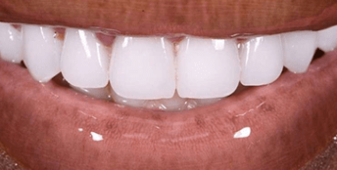 After - Sutton Aesthetic