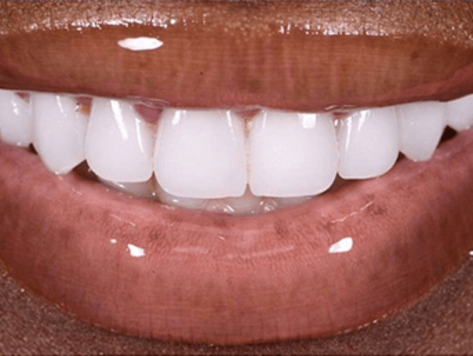 After Sutton Aesthetic Dentistry