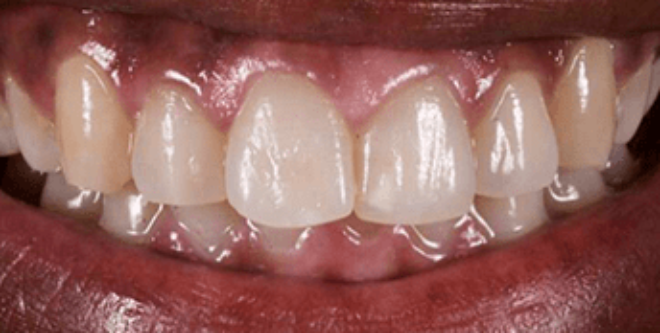 Before - Sutton Aesthetic