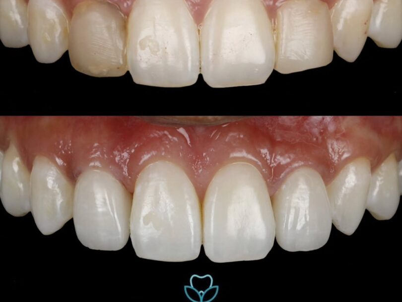 Dental Care in Sutton Coldfield