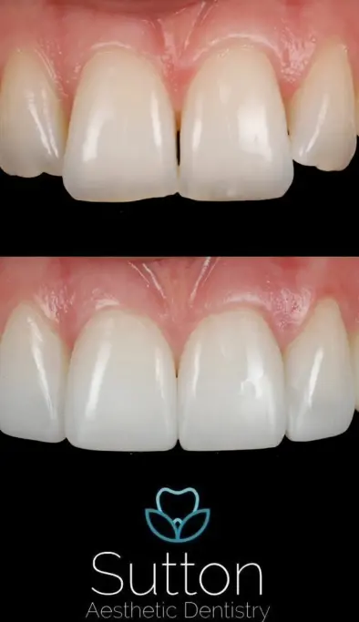 Mask group - 2026-04-06T144628.370